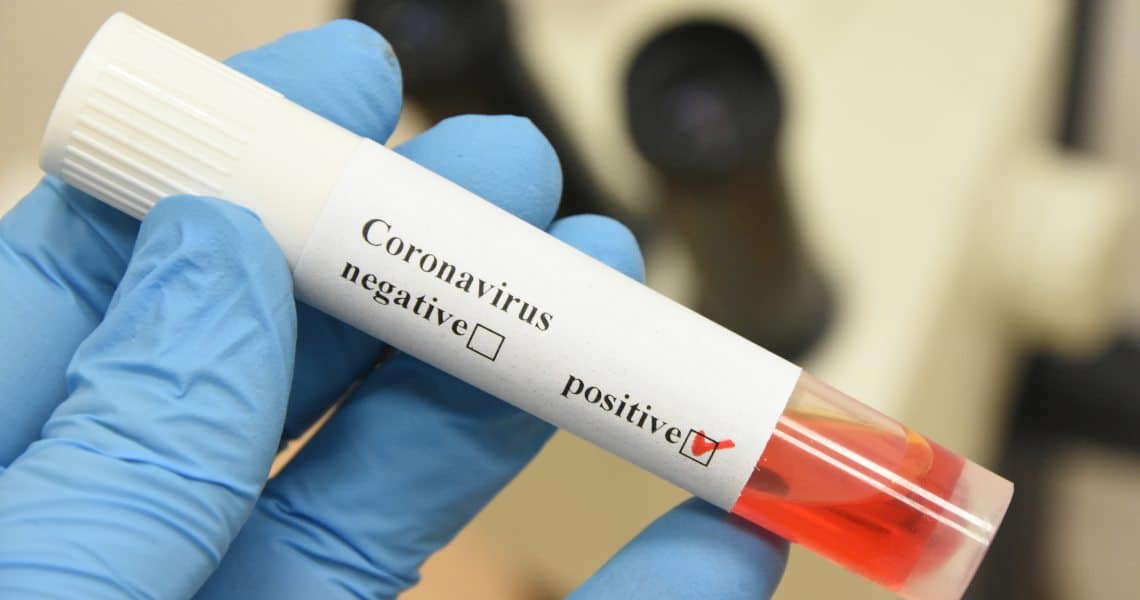 Ripple: Chris Larsen guarito dal Coronavirus