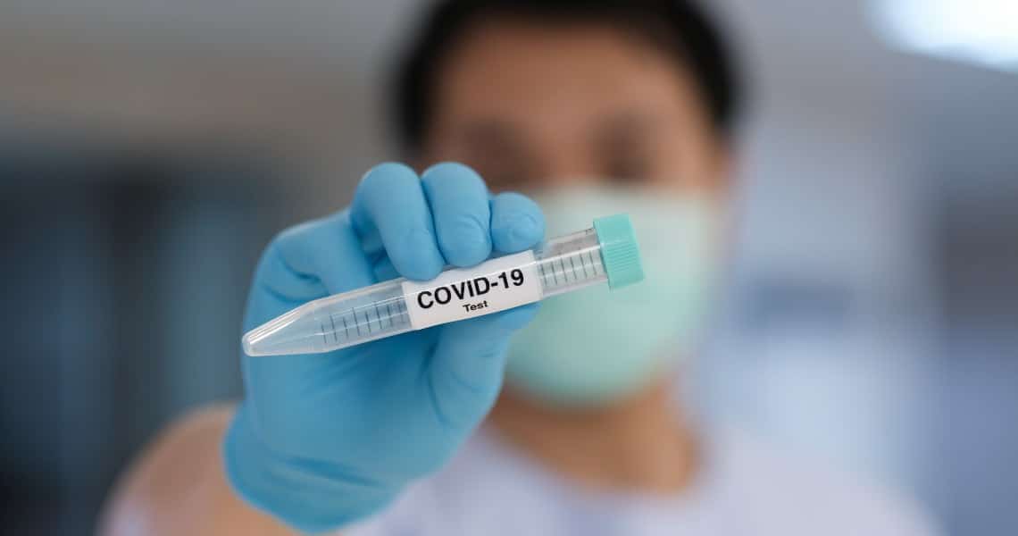 Covid-19 kit diagnostico